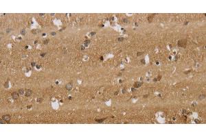 Immunohistochemistry of paraffin-embedded Human brain tissue using KCNMB2 Polyclonal Antibody at dilution 1:40 (KCNMB2 antibody)