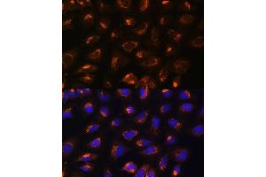 Immunofluorescence analysis of U2OS cells using MEK2 antibody (ABIN7268640) at dilution of 1:100. (MEK2 antibody  (AA 1-100))