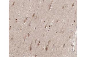 ABIN6267379 at 1/200 staining human brain tissue sections by IHC-P. (Cyclin B1 antibody  (pSer126))