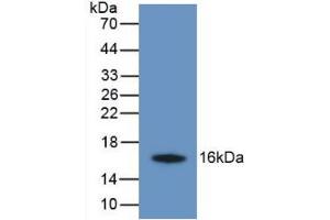 Figure. (TMEM27 antibody  (AA 17-137))