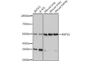 Western blot analysis of extracts of various cell lines, using BMP15 Rabbit mAb (ABIN7265896) at 1:1000 dilution. (BMP15 antibody)