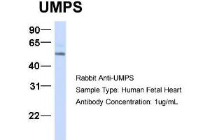 Western Blotting (WB) image for anti-Uridine Monophosphate Synthetase (UMPS) (C-Term) antibody (ABIN2783243)
