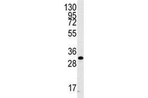 Western blot analysis of CDC2 antibody and A2058 cell lysate.