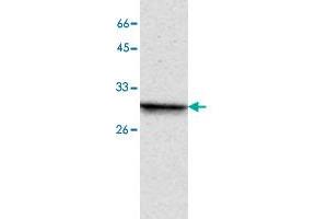 Western blot analysis of MCF-7 whole cell lystae with PPP4C monoclonal antibody, clone 2  at 1:1000 dilution. (PPP4C antibody)