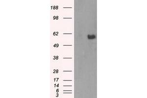 HEK293T cells were transfected with the pCMV6-ENTRY control (Left lane) or pCMV6-ENTRY AKT2 (Right lane) cDNA for 48 hrs and lysed. (AKT2 antibody)