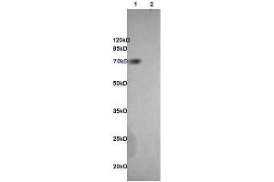 L1 rat brain, L2 rat heart lysates probed (ABIN707561) at 1:200 in 4 °C. (Endoglin antibody  (AA 58-110))