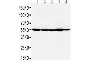 Anti-HDAC2 antibody, Western blotting Lane 1: MM453 Cell Lysate Lane 2: MCF-7 Cell Lysate Lane 3: HELA Cell Lysate Lane 4: SMMC Cell Lysate Lane 5: COLO320 Cell Lysate (HDAC2 antibody  (C-Term))