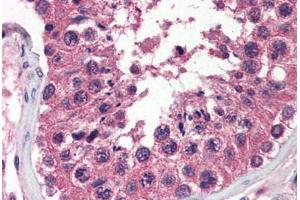 Human Testis (formalin-fixed, paraffin-embedded) stained with UNG antibody ABIN364332 at 10 ug/ml followed by biotinylated anti-mouse IgG secondary antibody ABIN481714, alkaline phosphatase-streptavidin and chromogen. (UNG antibody  (AA 1-313))