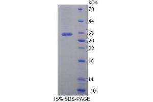 SDS-PAGE (SDS) image for Zinc Finger Protein 10 (ZNF10) (AA 1-244) protein (His tag) (ABIN6238986) (ZNF10 Protein (AA 1-244) (His tag))