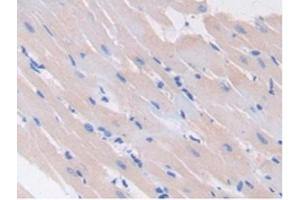 Detection of GAD2 in Rat Heart Tissue using Polyclonal Antibody to Glutamate Decarboxylase 2 (GAD2) (GAD65 antibody  (AA 188-374))