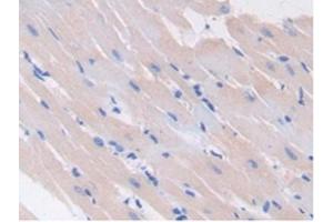 Detection of GAD2 in Rat Heart Tissue using Polyclonal Antibody to Glutamate Decarboxylase 2 (GAD2) (GAD65 antibody  (AA 188-374))