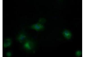 Image no. 6 for anti-Mitochondrial Ribosomal Protein S34 (MRPS34) antibody (ABIN1499565) (MRPS34 antibody)