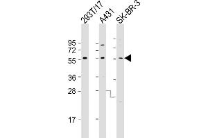 All lanes : Anti-p53 Antibody (p53-) at 1:1000-1:2000 dilution Lane 1: 293T/17 whole cell lysate Lane 2: A431 whole cell lysate Lane 3: SK-BR-3 whole cell lysate Lysates/proteins at 20 μg per lane. (p53 antibody  (C-Term))
