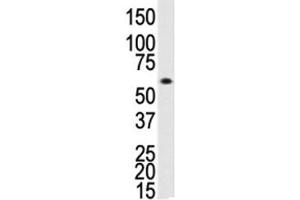 Western Blotting (WB) image for anti-Bone Morphogenetic Protein Receptor 1A (BMPR1A) (AA 30-60) antibody (ABIN3030186)