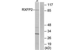 Western blot analysis of extracts from Jurkat cells, using RXFP2 Antibody. (RXFP2 antibody  (AA 113-162))