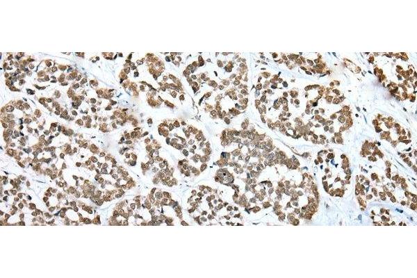 ZNF486 antibody