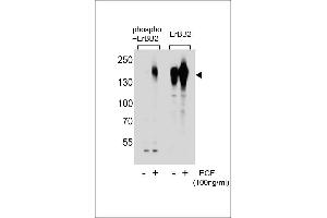 Western blot analysis of extracts from A431 cells, untreated or treated with EGF, using phospho-ERBB2- (left) or ErBB2 Antibody (right). (ErbB2/Her2 antibody  (pSer1107))