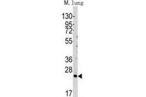 Western Blotting (WB) image for anti-BH3 Interacting Domain Death Agonist (BID) (BH3 Domain) antibody (ABIN2997129) (BID antibody  (BH3 Domain))