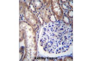 Immunohistochemistry (IHC) image for anti-Guanine Nucleotide Binding Protein (G Protein), alpha 14 (GNa14) antibody (ABIN2996930) (GNa14 antibody)