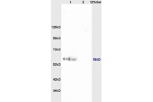SDS-PAGE (SDS) image for anti-Ribosomal Protein S6 Kinase, 70kDa, Polypeptide 1 (RPS6KB1) (pSer427) antibody (ABIN713006)