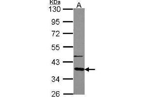 Western Blotting (WB) image for anti-Guanine Nucleotide Binding Protein (G Protein), alpha Transducing Activity Polypeptide 2 (GNAT2) (Center) antibody (ABIN2856958)