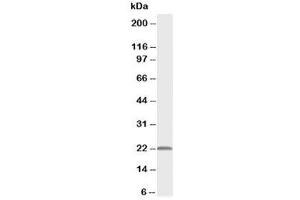 Western blot testing of PMVK antibody and rat heart tissue lysate (PMVK antibody  (Middle Region))