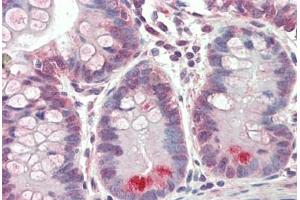 Human Small Intestine: Formalin-Fixed, Paraffin-Embedded (FFPE) (GUCA2A antibody  (AA 56-105))