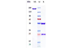 Anti-PDCD1 / PD-1 / CD279 Reference Antibody (spartalizumab) on SDS-PAGE under reducing (R) condition. (Recombinant PDCD1 (Spartalizumab Biosimilar) antibody)