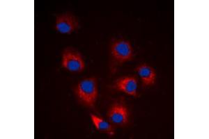 Immunofluorescent analysis of BIM (pS69) staining in HeLa cells. (BIM antibody  (pSer69))