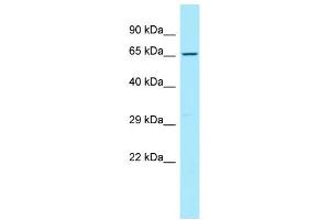 WB Suggested Anti-CD96 Antibody Titration: 1. (CD96 antibody  (C-Term))