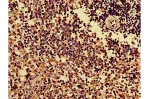 Immunohistochemistry (IHC) image for anti-Major Histocompatibility Complex, Class I, B (HLA-B) (AA 25-308) antibody (ABIN7155621)