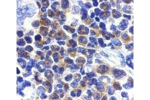 Immunohistochemical staining of DAPK2 in mouse spleen cells with DAPK2 antibody at 2μg/ml. (DAPK2 antibody  (AA 356-370))