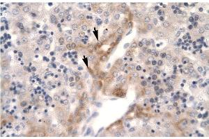 Human Liver (FOSL2 antibody  (Middle Region))