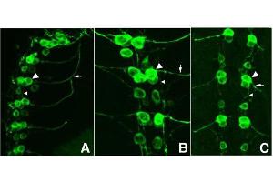 Immunofluorescence Microscopy of GFP-GOAT-Antibody. (GFP antibody)