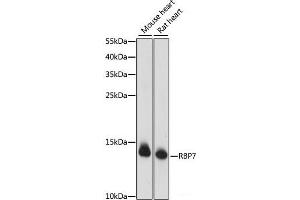 Western blot analysis of extracts of various cell lines using RBP7 Polyclonal Antibody at dilution of 1:1000. (RBP7 antibody)
