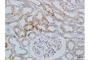 Formalin-fixed and paraffin-embedded : rat kidney tissue labeled with Rabbit Anti-Integrin alpha E2 Polyclonal Antibody, Unconjugated (ABIN678758) 1:200 followed by conjugation to the secondary antibody and DAB staining (Integrin, alpha E2 (AA 1101-1179) antibody)