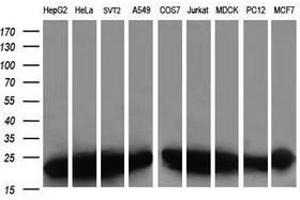 Image no. 6 for anti-Prefoldin Subunit 3 (PFDN3) antibody (ABIN1501701) (VBP1 antibody)