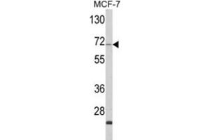 ZYG11A antibody