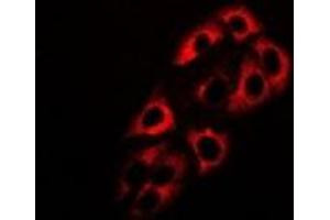 Immunofluorescent analysis of ADH5 staining in HepG2 cells.