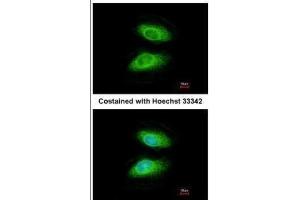 ICC/IF Image Immunofluorescence analysis of methanol-fixed HeLa, using IRAK2, antibody at 1:200 dilution. (IRAK2 antibody)