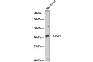 Western blot analysis of extracts of NCI-H460 cells using STAT4 Polyclonal Antibody at dilution of 1:1000. (STAT4 antibody)