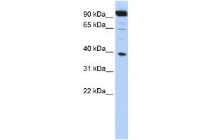 Western Blotting (WB) image for anti-Homeobox B2 (HOXB2) antibody (ABIN2458159) (HOXB2 antibody)
