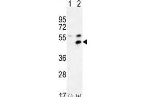Western Blotting (WB) image for anti-Membrane Protein, Palmitoylated 1, 55kDa (MPP1) antibody (ABIN2995793)