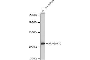 Western blot analysis of extracts of Mouse spleen, using  Rabbit pAb (ABIN7269965) at 1:1000 dilution. (ARHGAP30 antibody  (AA 485-585))