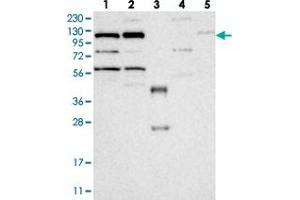 Western blot analysis of Lane 1: RT-4, Lane 2: U-251 MG, Lane 3: Human Plasma, Lane 4: Liver, Lane 5: Tonsil with KIF5C polyclonal antibody  at 1:250-1:500 dilution. (KIF5C antibody)