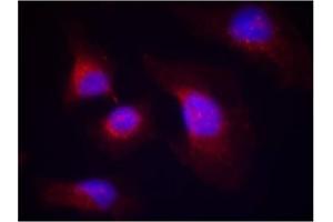 Image no. 2 for anti-Spleen tyrosine Kinase (SYK) (pTyr323) antibody (ABIN319291)