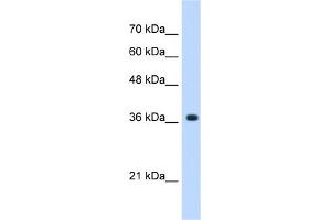 WB Suggested Anti-A4GNT Antibody Titration:  0. (A4GNT antibody  (C-Term))