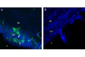 anti-Cholinergic Receptor, Muscarinic 3 (CHRM3) (AA 47-62), (Extracellular), (N-Term) antibody
