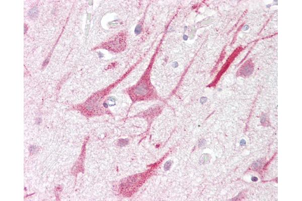 ZMYM2 antibody  (C-Term)