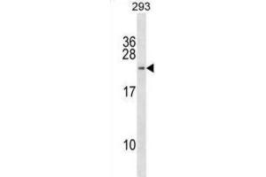 Western Blotting (WB) image for anti-H2B Histone Family, Member W, Testis-Specific (H2BFWT) antibody (ABIN2998902)
